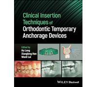 Clinical Insertion Techniques of Orthodontic Temporary Anchorage Devices