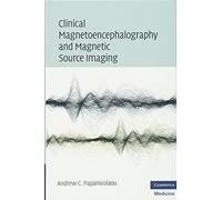 Clinical Magnetoencephalography and Magnetic Source Imaging