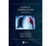 Clinical Tuberculosis