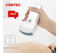 CMS1600A handheld dual-probe color Doppler ultrasound diagnostic system