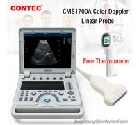 CMS1700A Color Doppler Ultrasonic Diagnostic CF Ultrasound Scanner+Linear Probe