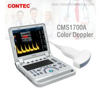 CMS1700A Color Doppler Ultrasonic Diagnostic CF Ultrasound Scanner USG Convex