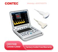 CMS1700B Color Doppler CF Ultrasound Scanner Machine USG Convex+Linear Probe FDA