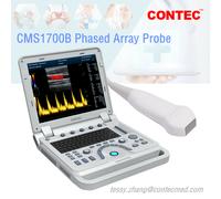 CMS1700B Color Doppler CF Ultrasound Scanner Machine USG Phased Array Probe FDA