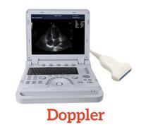 CMS1700B Portable ultrasound Scanner Color doppler Diagnostic SystemLinear probe