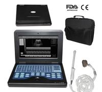 CMS600P2 Portable Ultrasound Scanner Diagnostic Laptop Machine & probe OPTIONAL