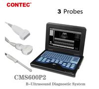 CMS600P2 Portable Ultrasound Scanner Diagnostic Laptop Machine & probe OPTIONAL