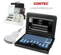 CMS600P2 ultrasound scanner laptop machine diagnostic system 3.5mhz convex probe