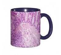 Coffee Mug Funny Mug, Histology Intestine Human Tissue Show Epithelium Tissue Tissue Microscope View Print,Coloured Mug Cup Gift Birthday Work Office Christmas Tea Coffee