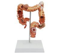 Colon Anatomy Model - Human Organ Model for Gastroenterology and Proctology Medical Teaching and Study