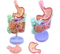 Colon and Rectum Anatomy Model: Gastrointestinal Lesion, Colonic Pathology