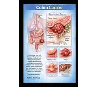 Colon Cancer Healed Naturally: Food, Herbs, Supplements and detox to beat Colon Cancer