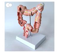 Colon Model, 3D Human Anatomy Model, Human Anatomical Anatomy Digestive System, Replica for Human Anatomy and Physiology Education