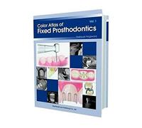 Color Atlas of Fixed Prosthodontics: Vol 1