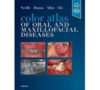 Color Atlas of Oral and Maxillofacial Diseases