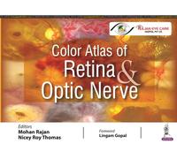 Color Atlas of Retina & Optic Nerve