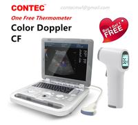 Color Doppler Ultrasound Scanner Portable Laptop Machine Color Diagnostic Convex
