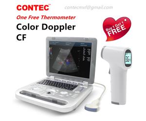 Color Doppler Ultrasound Scanner Portable Laptop Machine Color Diagnostic Convex