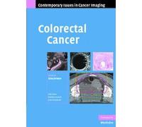 Colorectal Cancer (Contemporary Issues in Cancer Imaging)