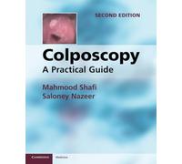 Colposcopy: A Practical Guide