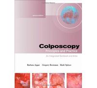 Colposcopy: Principles and Practice
