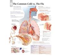 Common Cold vs the Flu Laminated Poster