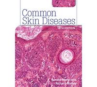 Common Skin Diseases 18th edition: ISE