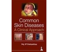 Common Skin Diseases