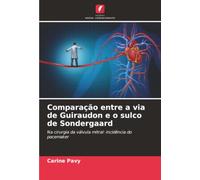 Comparação entre a via de Guiraudon e o sulco de Sondergaard: Na cirurgia da válvula mitral: incidência do pacemaker