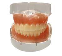 Complete Denture Model with 28 Removable Teeth, Transparent Base, Resin Adult Teeth Model for Dental Study, Dentist-Patient Communication, Oral Teaching