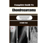 Complete Guide To Chondrosarcoma: Empowering Patients And Caregivers With Evidence-Based Treatment Insights, Symptom Management, Support, And Hope