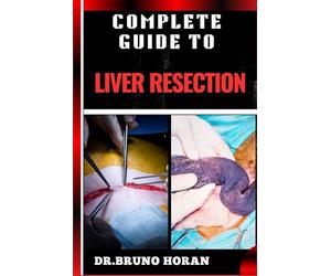 COMPLETE GUIDE TO LIVER RESECTION: Detailed Guide To Hepatic Surgery, Recovery, Post Op Care, Complications, And Diet Management