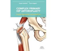 Complex Primary Hip Arthroplasty: Surgical Approaches and Procedures