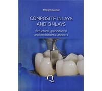 Composite Inlays and Onlays: Structural, Periodontal, and Endodontic Aspects