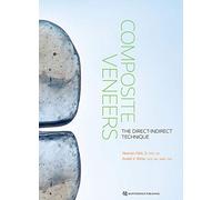 Composite Veneers: The Direct-Indirect Technique