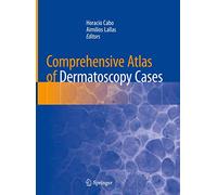 Comprehensive Atlas of Dermatoscopy Cases