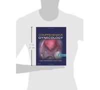 Comprehensive Gynecology