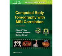 Computed Body Tomography with MRI Correlation