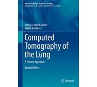 Computed Tomography of the Lung : A Pattern Approach