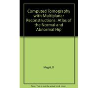Computed Tomography with Multiplanar Reconstructions - Atlas of the Normal: An Atlas of the Normal and Abnormal Hip