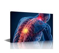Concept Human Anatomy X-Ray Posters Home Decor Wall Pain in the Neck and Lower Back Posters for Room Aesthetic House Decorations Giclee Wooden Framed Gallery-Wrapped Ready to Hang (16"Wx24"H)