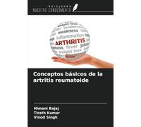 Conceptos básicos de la artritis reumatoide