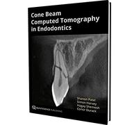 Cone Beam Computed Tomography in Endodontics
