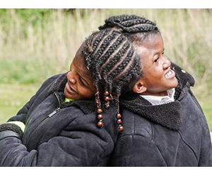 Conjoined Twin Sisters Attached At The Head
