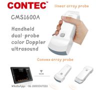 full digital B-Ultrasound Scanner 10.1 inch Laptop Machine Convex Linear Probe