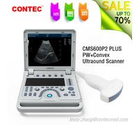 CONTEC CMS600P2 PLUS Ultrasound Scanner PW Diagnostic Systems with Convex Probe