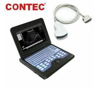 CONTEC CMS600P2 Portable Ultrasound Scanner Laptop Machine +3.5MHZ Convex probe