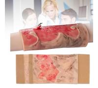 COYEUX Simulated Burn Wound Model, 2-3 Degree Limb Burn Training Model, Wearable Burn Injury Demonstration Pad, Realistic Appearance Design, for Burn Care, Teaching Demonstration, Education