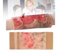 COYEUX Simulated Burn Wound Model, 2-3 Degree Limb Burn Training Model, Wearable Burn Injury Demonstration Pad, Realistic Appearance Design, for Burn Care, Teaching Demonstration