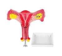 Cpolebev 1:1 Human Female Uterus Ovary Fallopian Tubes Model Anatomical Human Anatomy Model Teaching Tools